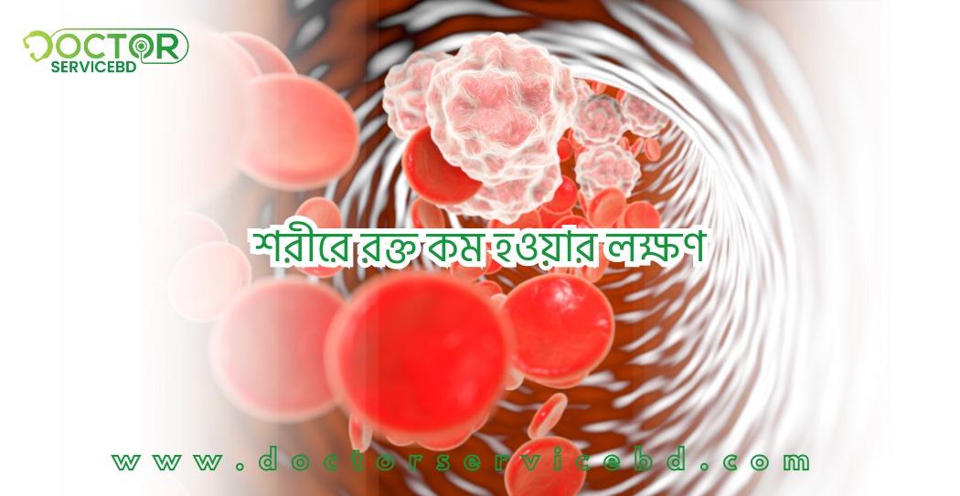 blog-image