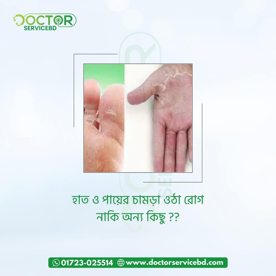 blog-image