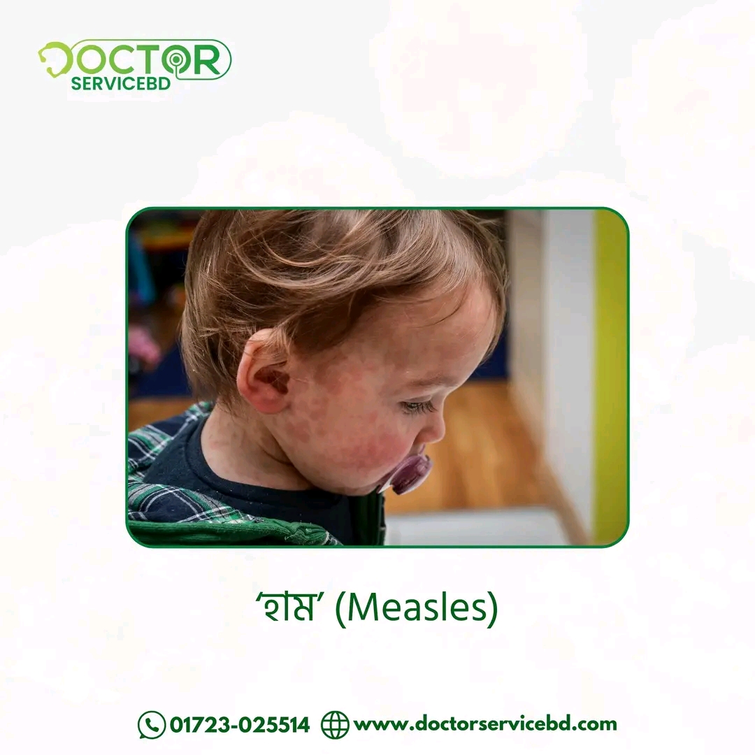 blog-image