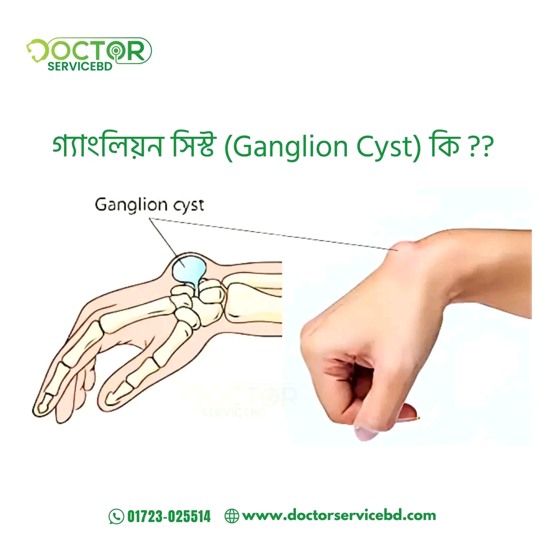 blog-image