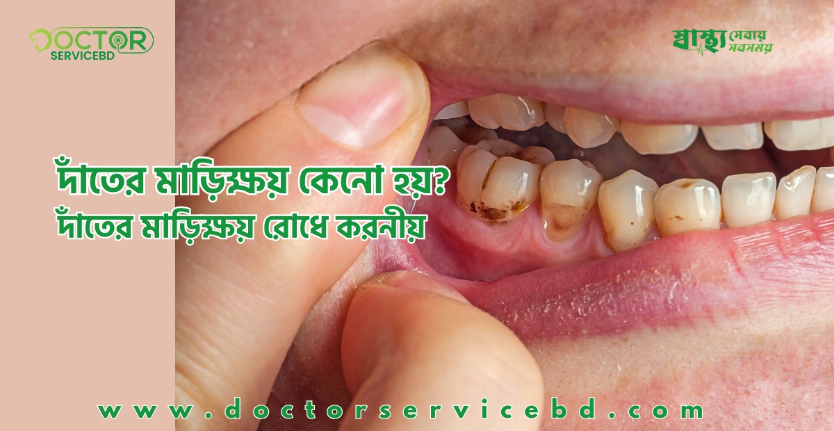 blog-image