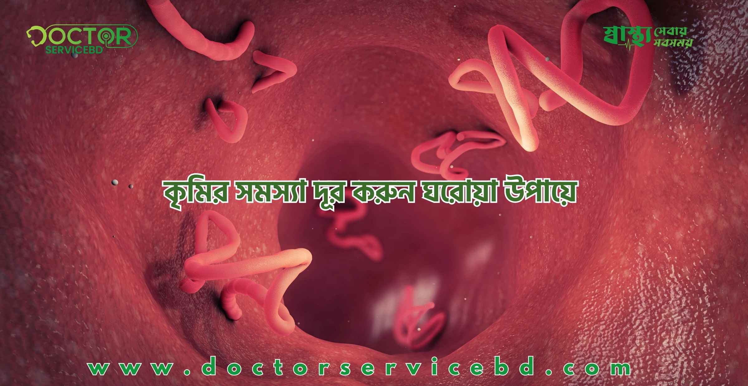 blog-image