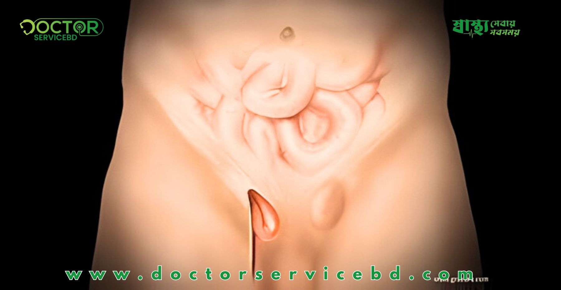 blog-image
