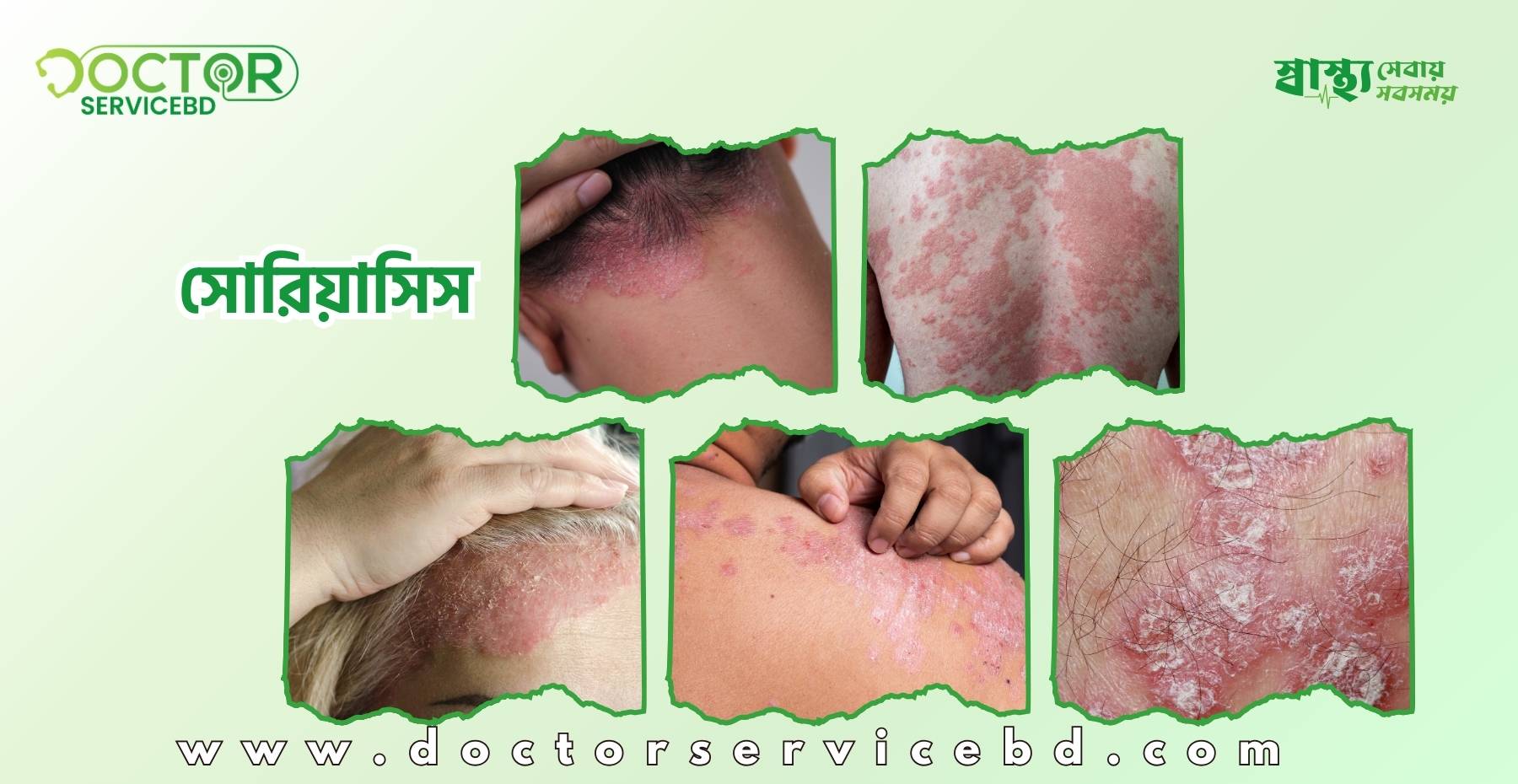 blog-image