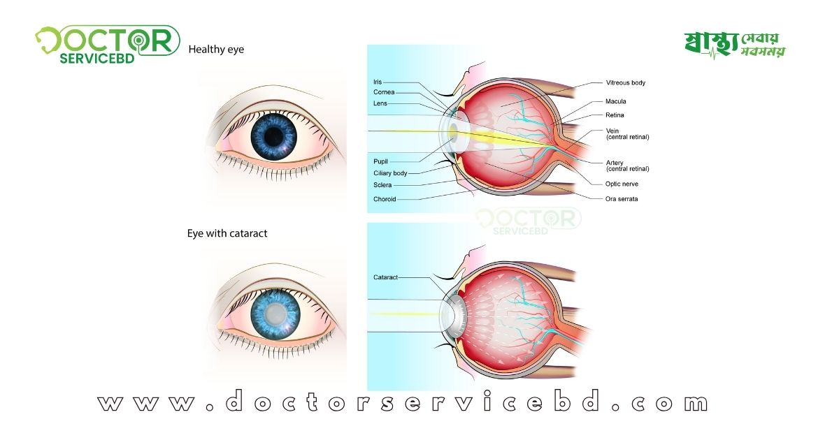 blog-image