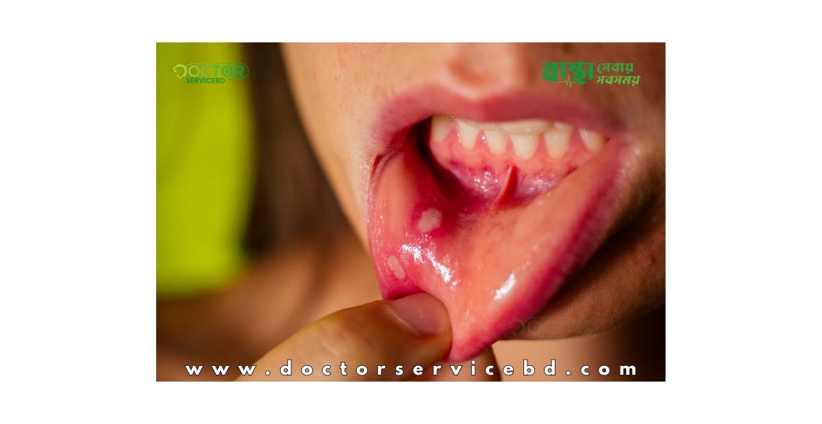 blog-image