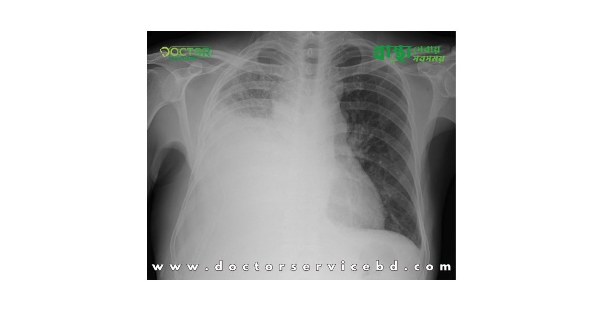 blog-image