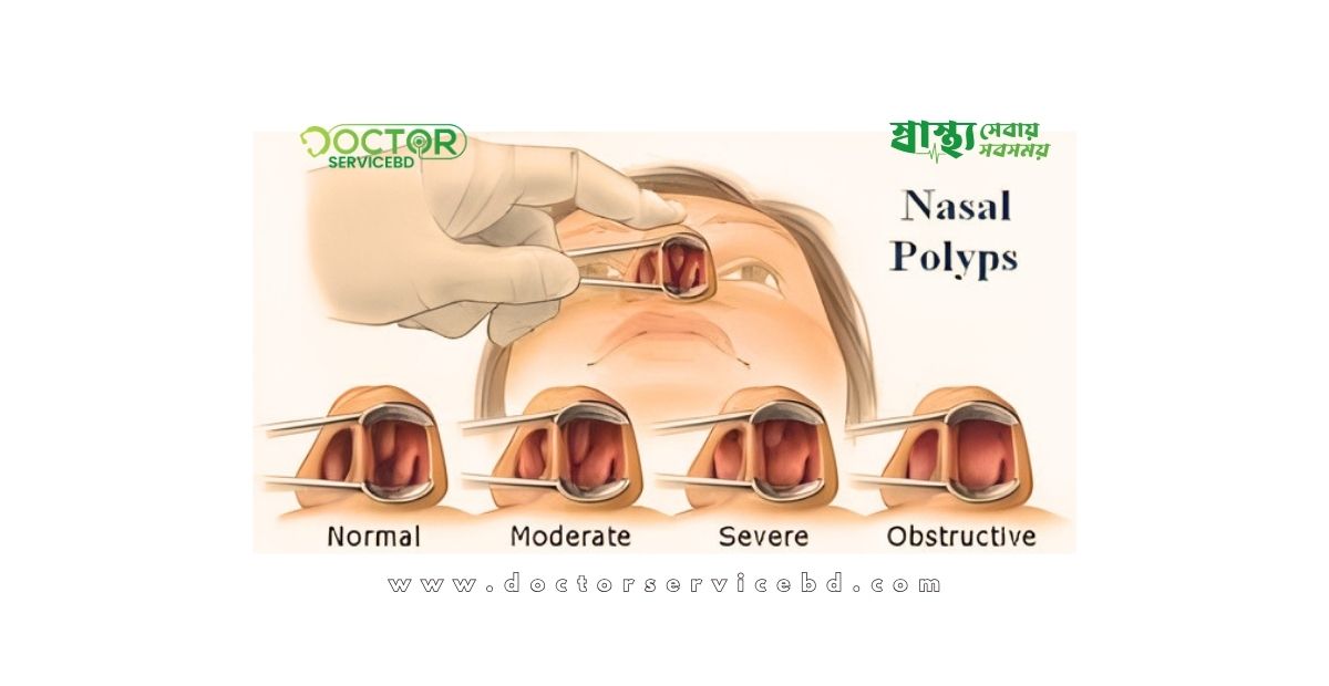 blog-image