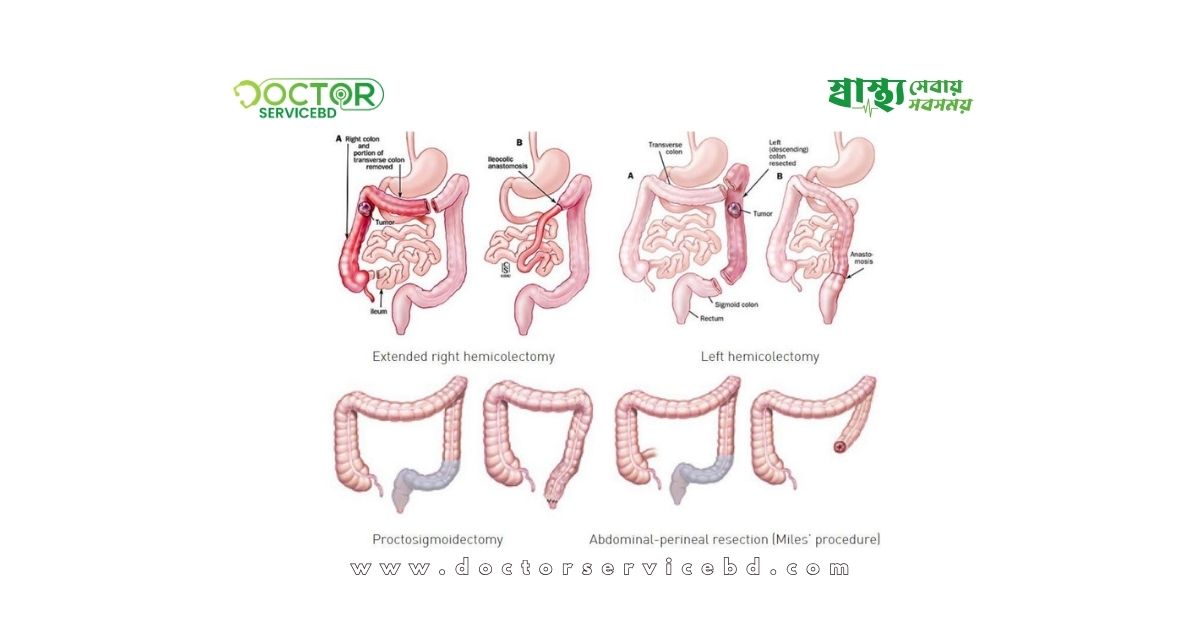 blog-image