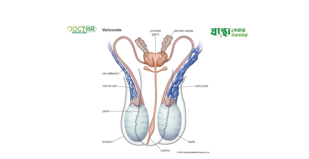 blog-image