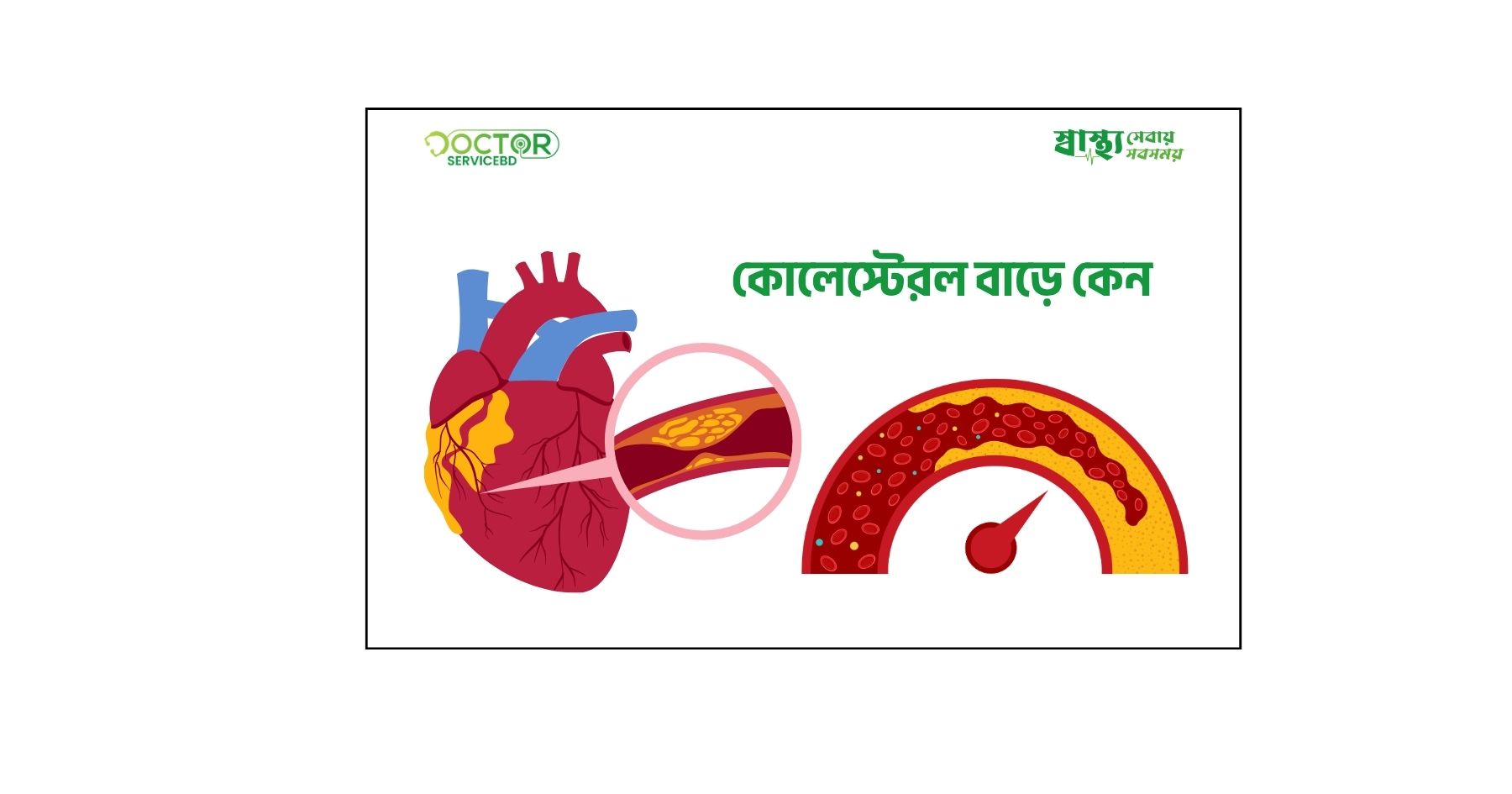 blog-image