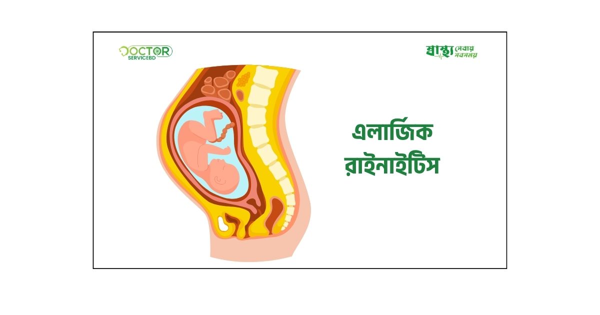 blog-image