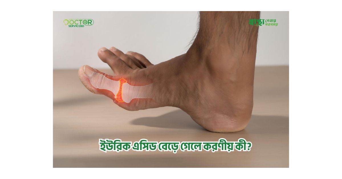 blog-image