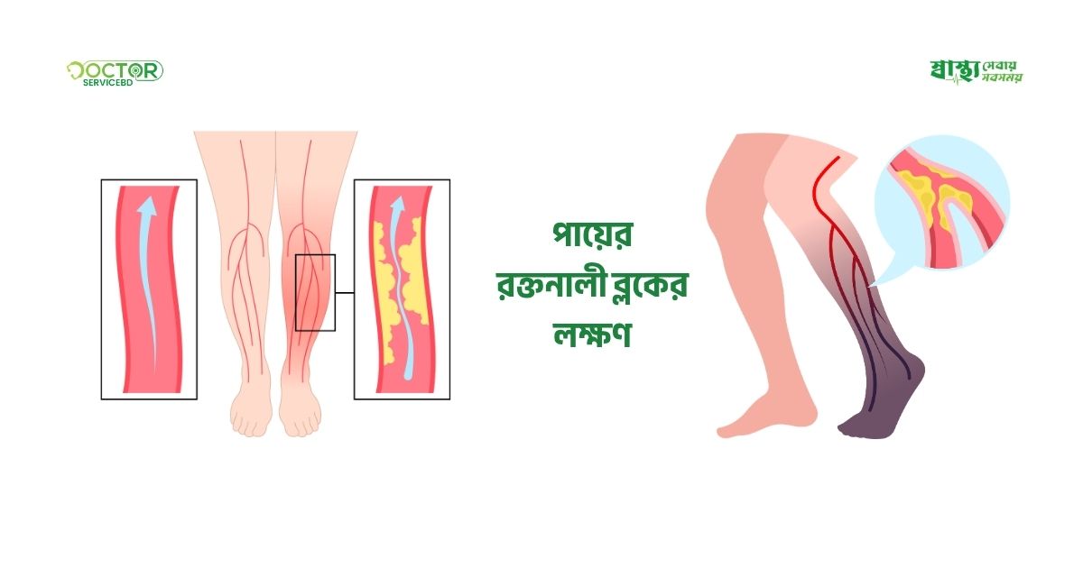 blog-image