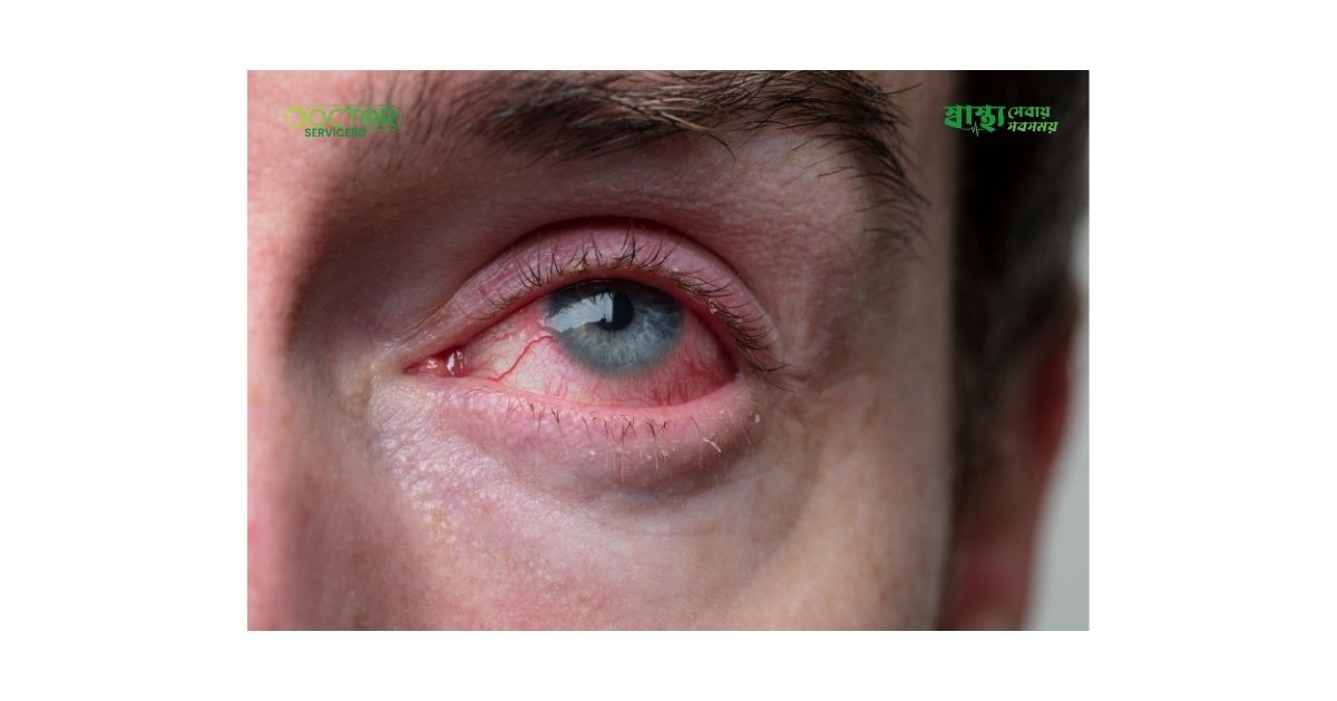 blog-image