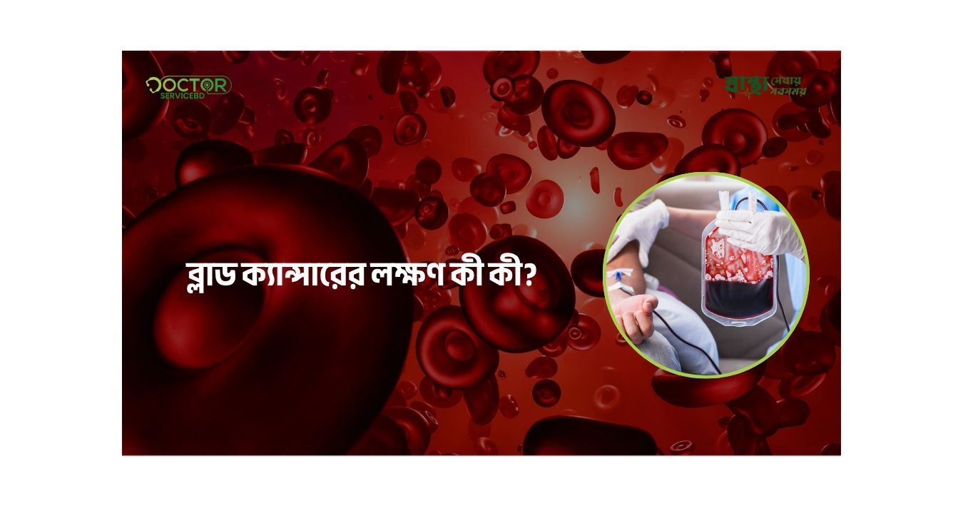 blog-image