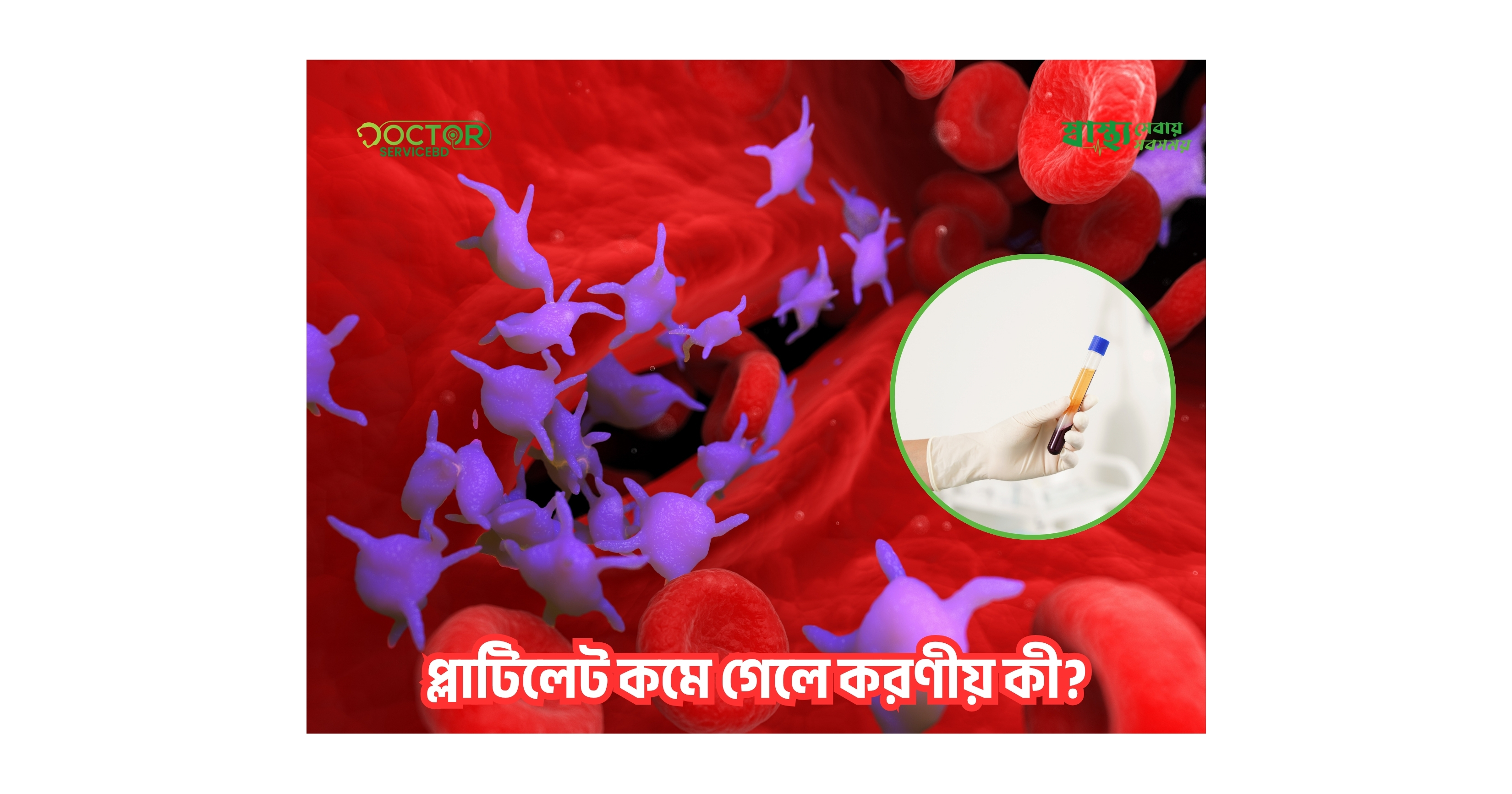 blog-image